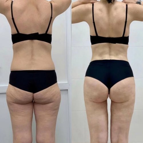 slimtime before after 10